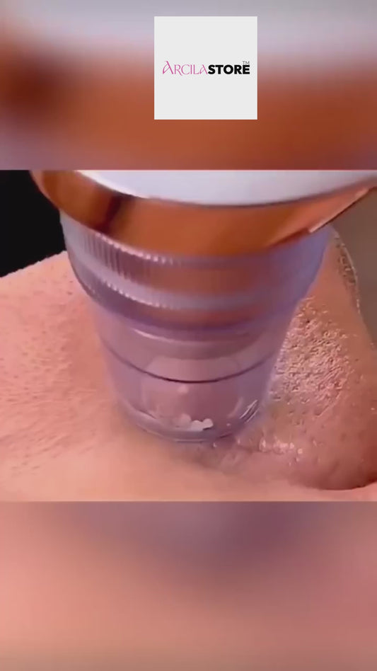 EXFOLIEUR FACIAL - ASPIRATEUR - NETTOYEUR -4 en 1- ARCILASTORE™